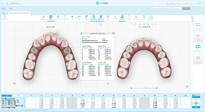 3Dデジタル技術を使用した治療のプランニング