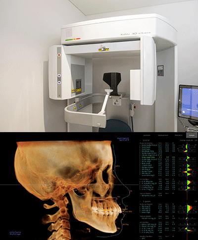 CBCT